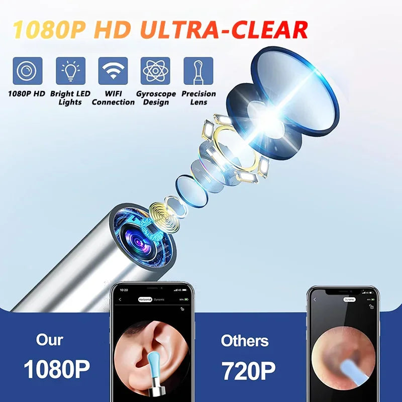 Ear Wax Cleaner with Camera